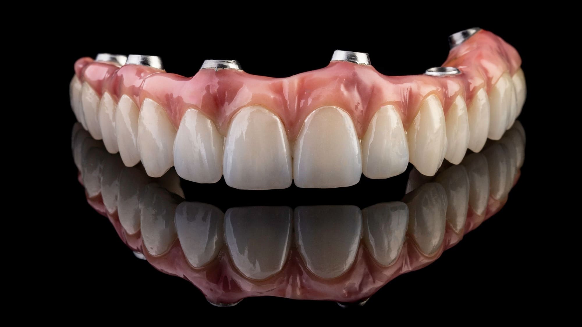 implante dentário em altamira - prótese dentária fixa